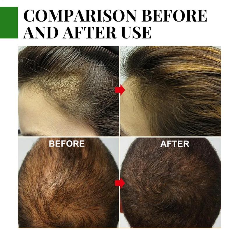 Rosemary Flourish Oil for Hair Growth 30ml