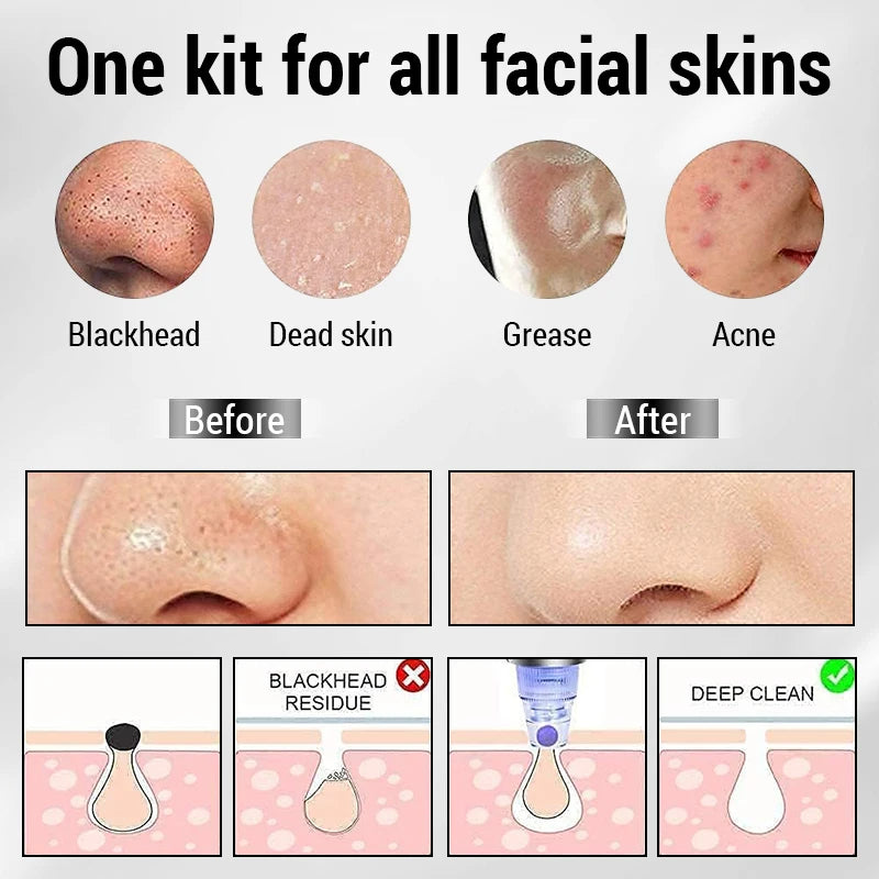 Pore Cleaning Device