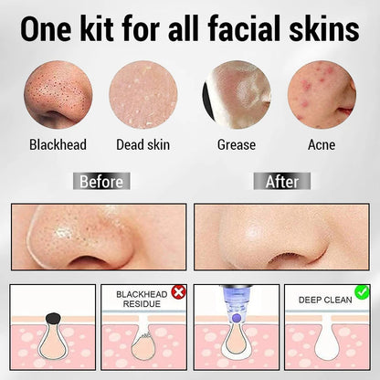 Pore Cleaning Device